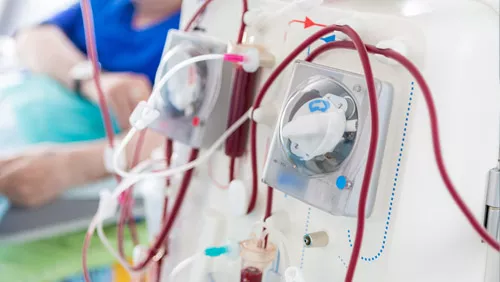 Dialysis